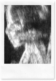 22-week-scan-close-up